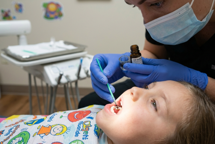 Dentist applying SDF to tooth